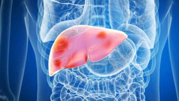 National NAFLD Control Programme: Launched in 2021, this program integrates liver disease control into a comprehensive non-communicable disease control programme.