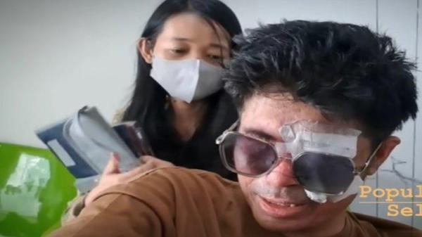 Agus Salim, korban penyiraman air keras di Jakarta kembali meminta pertolongan kepada Youtuber Pratiwi Noviyanthi. memelas mengeluhkan pengobatannya