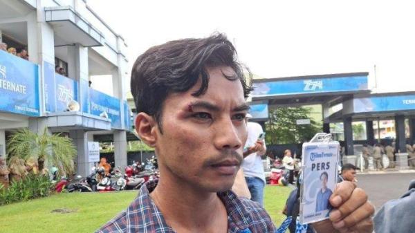 PEMUKULAN WARTAWAN M. Julfikram Suhadi, seorang wartawan Tribun Ternate, menjadi korban aksi pemukulan saat sedang meliput.  Insiden itu terjadi di depan kantor wali kota Ternate, Maluku Utara, pada Senin (24/2/2025) sore waktu setempat.