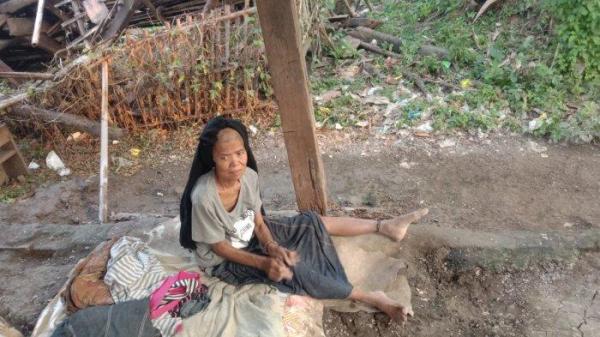 Nenek Munirah yang dipasung 6 tahun di Blok Dukuh Desa Gadingan, Kecamatan Sliyeg, Kabupaten Indramayu, Minggu (20/4/2025)