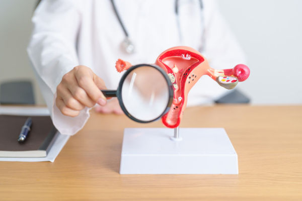 Ilustrasi kanker serviks. Foto: Shutterstock
