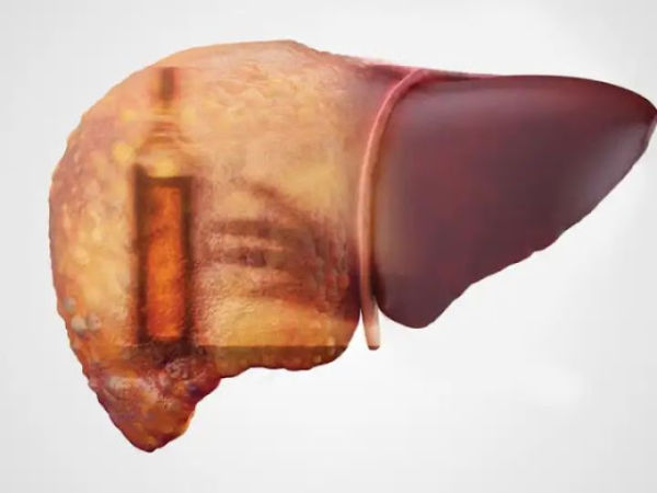 Leave alcohol, these 5 foods for liver are not less than acid, the liver starts melting while eating