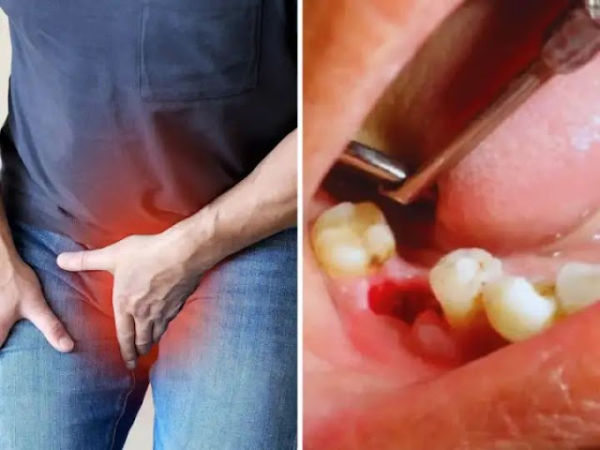 The person reached the dentist from the pain in the jaw, after uprooting the teeth, the cancer came out in the private part ...!