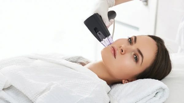Rf microneedling