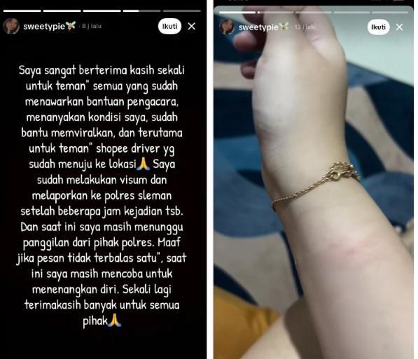 KORBAN : Unggahan korban penganiayaan dari mas mas pelayaran di Sleman yang marah karena pesanan telat 5 menit. Korban sudah melakukan visum.