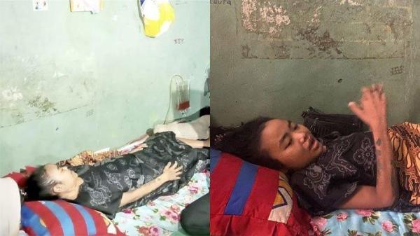 LUMPUH - Seorang ibu bernama Ratih Raynada (30) diduga menjadi korban malpraktik. Ia menyebut, kondisinya menurun usai menjalani operasi caesar anak keempat di RSUD dr Chasbullah Abdulmadjid, Kota Bekasi, pada September 2024.
