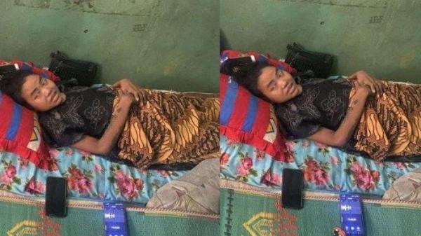 CAESAR - Ratih Raynada (30) kini hanya mampu berbaring di atas kasur usai tubuhnya lumpuh karena operasi caesar anak keempatnya di RSUD dr Chasbullah Abdulmadjid, Kota Bekasi, pada September 2024.