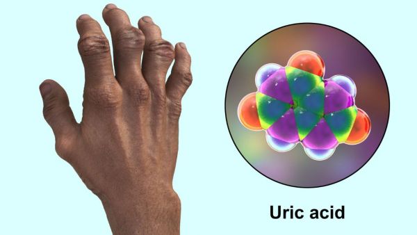 Which organs have the highest effect on uric acid? Complete information in easy language Which organs have the highest effect on uric acid? Complete information in easy language