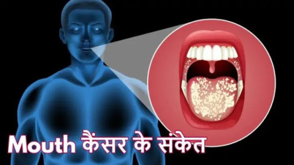 When do teeth become the cause of cancer? Know the opinion of experts ..