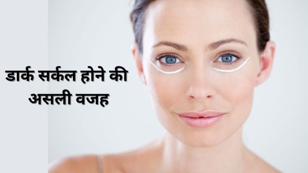 What is the real reason for getting a dark circle, how to get rid of, the expert told