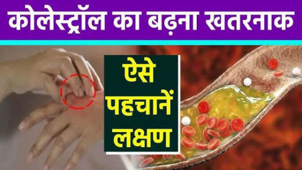 This warning signal gives this warning signal when cholesterol increases, if not identified in time, then the risk of heart attack may increase ..