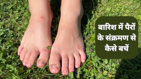 Monsoon Tips: Infection should not be done in the feet in the rain, take care of these things