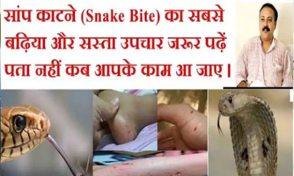 Do read the treatment of snake sting, I do not know when you can be useful.