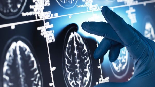 GLP-1 medication obesity, diabetes and now Alzheimer's treatment? Know what research says GLP-1 medication obesity, diabetes and now Alzheimer's treatment? Know what research says