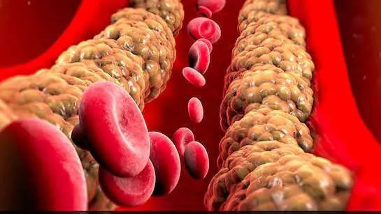 If you want to remove bad cholesterol stored in the body, then include these drinks in your diet