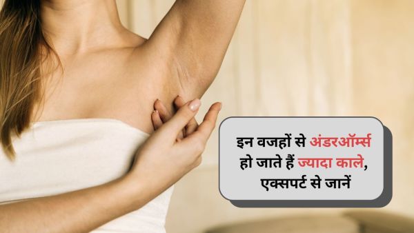 Are your underarms too black? These problems can happen, learn from experts Are your underarms too black? These problems can happen, learn from experts