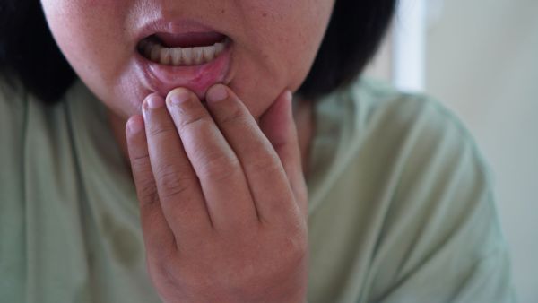 Frequent blisters in the mouth are stomach upset or something? The doctor told Frequent blisters in the mouth are stomach upset or something? The doctor told