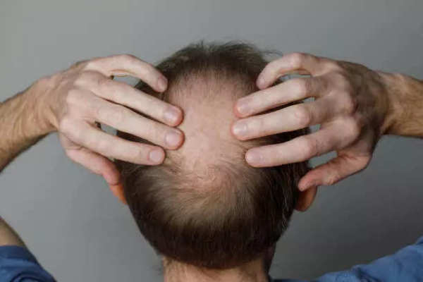 istockphoto-2166588243-612x612
