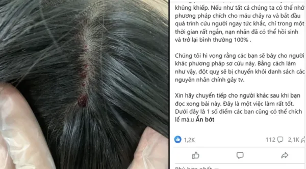 đột quỵ - Ảnh 1.