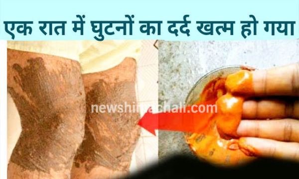 Many people say that the grease of the knees has ended, with this remedy the pain of knees will be removed in a minute…