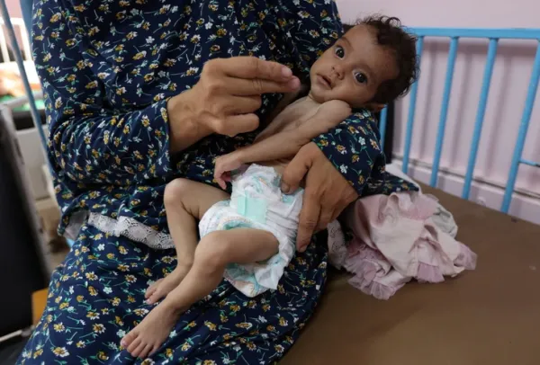 Bác sĩ ở Gaza ngất xỉu vì đói và kiệt sức trong lúc phẫu thuật - Ảnh 3. Gaza - Ảnh 3.