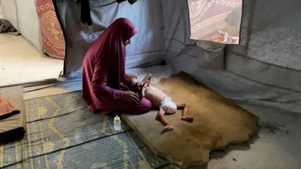 Bác sĩ ở Gaza ngất xỉu vì đói và kiệt sức trong lúc phẫu thuật - Ảnh 4. Bác sĩ ở Gaza ngất xỉu vì đói và kiệt sức trong lúc phẫu thuật - Ảnh 4.