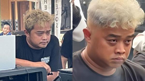 KANTONG MATA MENGHITAM - Wajah Ahmad Abdul Aziz (29) yang menjadi sorotan karena kantong matanya besar dan menghitam. Memed Sound Horeg, panggilan akrabnya banyak dibilang warganet pengguna narkoba karena kondisi kantong matanya tersebut, Selasa (29/7/2025).