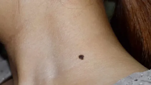 Samudra Shastra: There are sesame on these parts of the body, a sign of being lucky! Samudra Shastra: There are sesame on these parts of the body, a sign of being lucky!