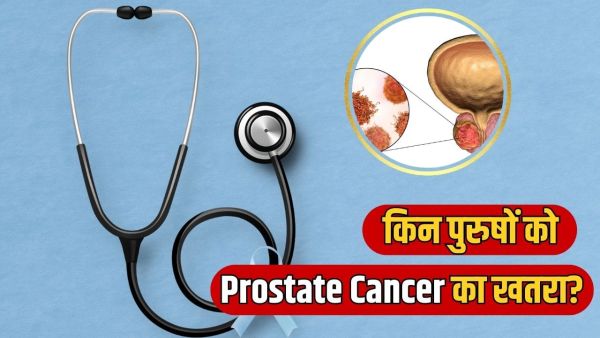 Pro State Cancer Risk: Which men are more at risk of prostate cancer? Learn from experts
