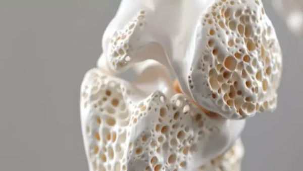 These 5 things from eating all calcium to the bones, they will leave these 5 things in the body.