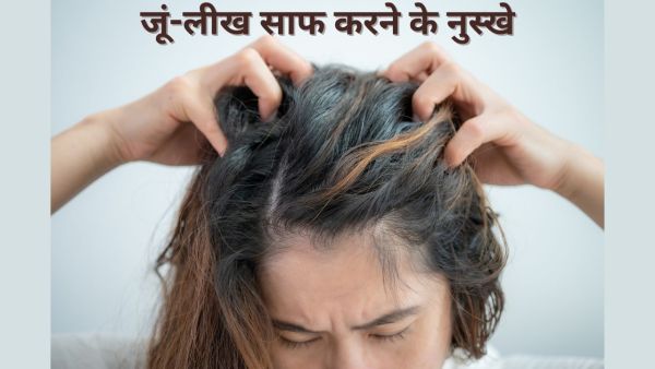 Lice and lichery in the head are disturbed, these home remedies will give good results in once