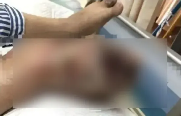 -