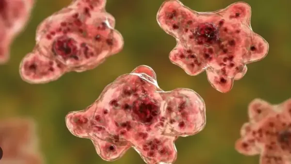 Symptoms of Amoeba