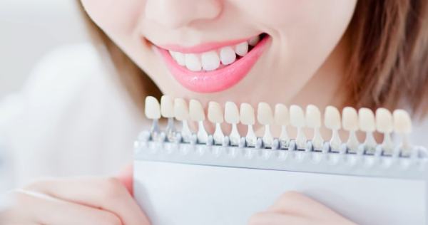 Ilustrasi bleaching gigi  Foto: Shutterstock