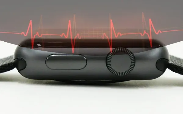 Apple Watch ECG