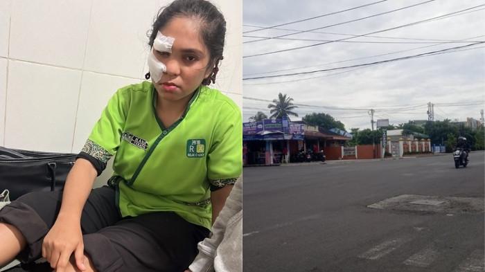 TABRAK LARI - TKP tabrak lari (kiri) dan salah satu korban tabrak lari (kanan).  Peristiwa tabrak lari kembali menggemparkan warga Kota Bengkulu. Kali ini, dua kakak beradik menjadi korban setelah sepeda motor yang mereka kendarai ditabrak sebuah mobil di Simpang Empat Lampu Merah Jalan Kapuas, Kamis malam (25/12/2025) sekitar pukul 21.20 WIB.