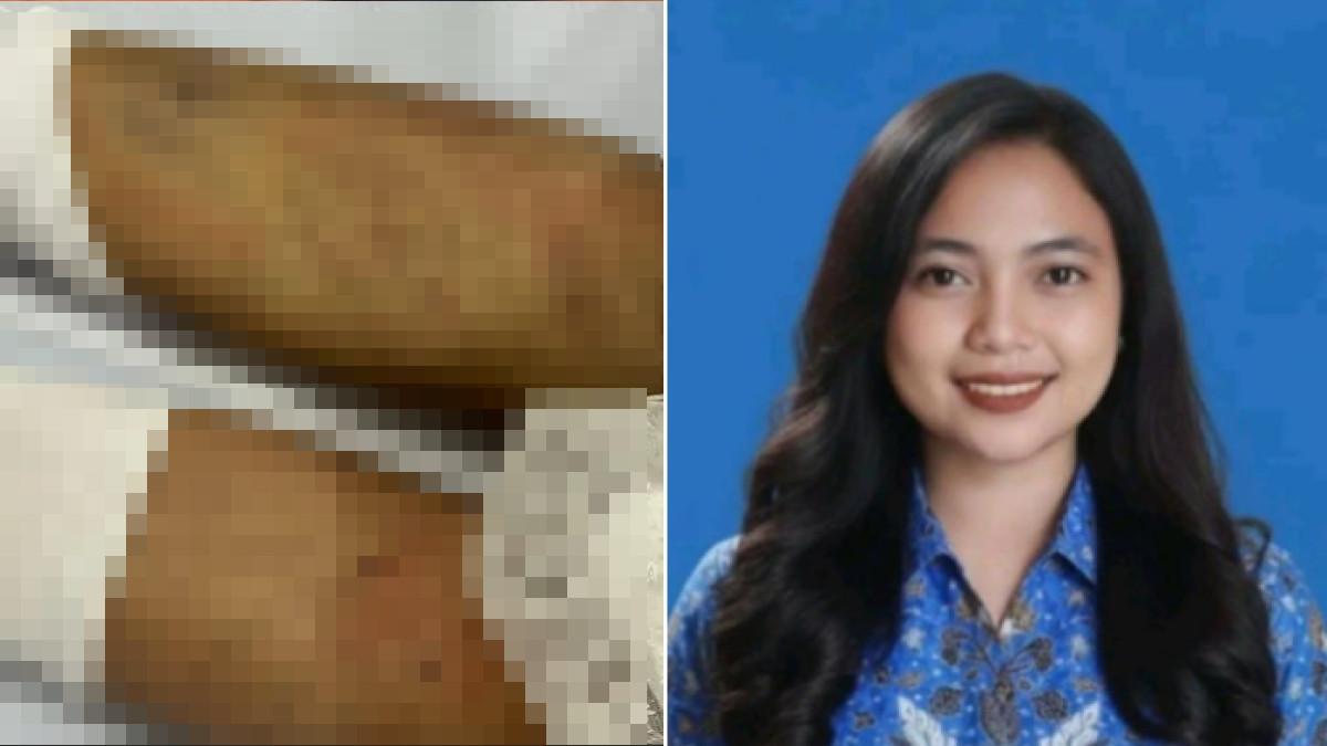 KEMATIAN MAHASISWI UNIMA - Evia Maria mahasiswi UNIMA ditemukan meninggal di kosnya di Tomohon pada Selasa pagi (30/12/2025). Keluarga memutuskan otopsi setelah menemukan sejumlah lebam biru dan luka mencurigakan di tubuh jenazah, sehingga rencana pemulangan ke kampung halaman di Siau ditunda.