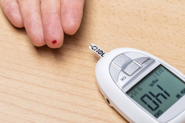 Ilustrasi tes kolesterol. Foto: Shutterstock