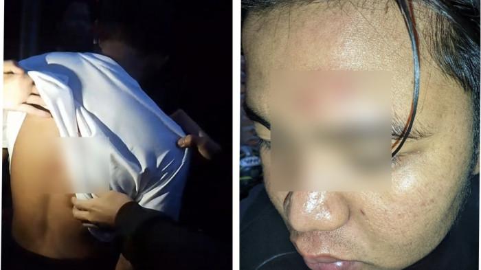 PENGEROYOKAN-Dua pemuda di Bengkulu menjadi korban penusukan oleh orang tak dikenal saat menunggu sunrise di kawasan wisata Danau Dendam Tak Sudah, Kota Bengkulu, Sabtu (10/1/2026) pagi. 