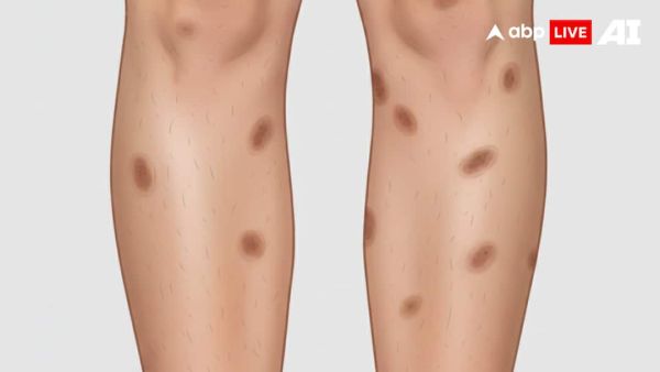 (Image Source: ABPLIVE AI)