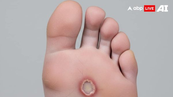 (Image Source: ABPLIVE AI)