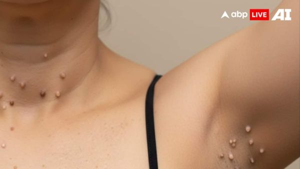 (Image Source: ABPLIVE AI)
