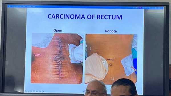 Delhi Aiims Robotic Surgery