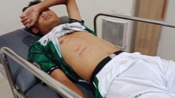 RIZAL TERBARING - Pemain Persikaba Blora, Rizal Dimas Agesta, masih trauma atas insiden yang menimpanya dalam pertandingan melawan PSIR Rembang, Rabu (21/1/2026). (Dok. Persikaba Blora)