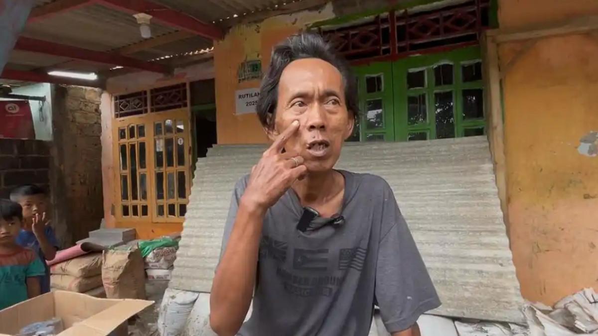 PENJUAL ES VIRAL  - Suderajat, penjual es kue yang difitnah oleh oknum aparat menunjukan sejumlah luka bekas penganiayaan yang dialaminya, Selasa (27/1/2026)