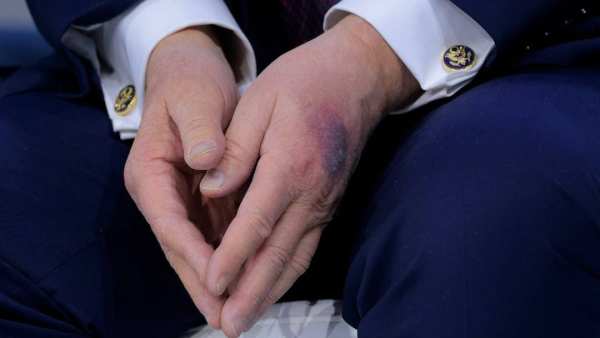 (Image Source: Twitter/@NesaraGesara0)