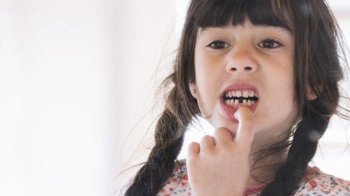 ilustrasi anak yang mengalami sakit gigi, berikut ini cara alami untuk mengatasi sakit gigi ringan pada anak