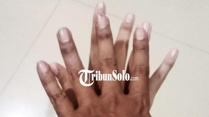 ILUSTRASI. Gambar tangan saling menindih beberapa waktu lalu. Di Klaten ayah dan anak melakukan pencabulan. 