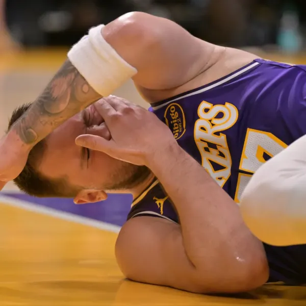 Luka Doncic reacts during Lakers game Thursday against 76ers.