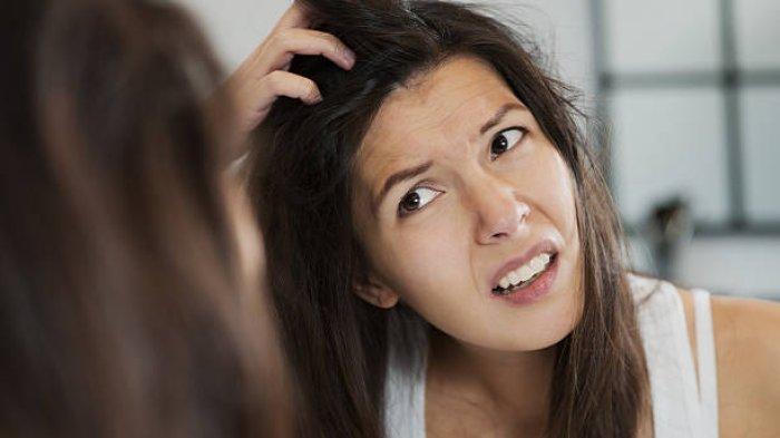 Ilustrasi seseorang yang mengalami ketombe, berikut perbedaan ketombe dan psoriasis